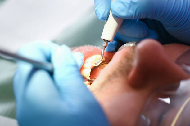 Best Broken or Cracked Tooth Emergency Dentist in Charleston, MO