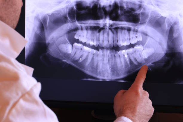 Best Emergency Dentist for Special Needs Patients in Charleston, MO